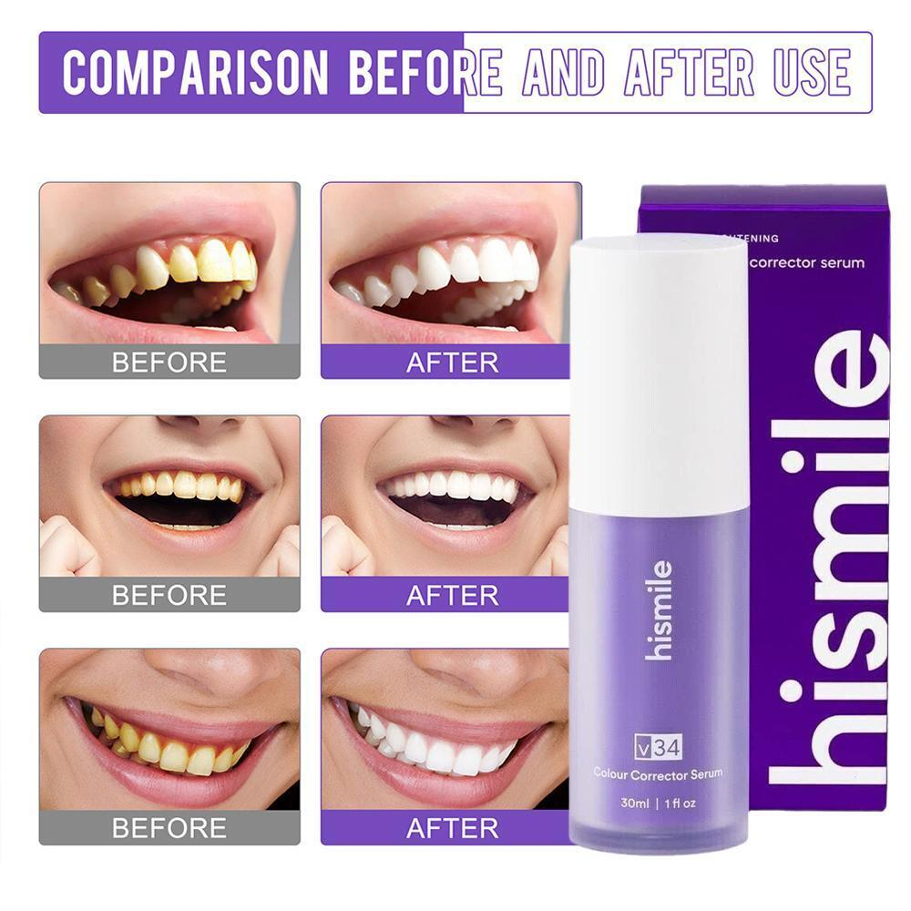 Hismile V34 Teeth Whitening Toothpaste (Australia Imported)